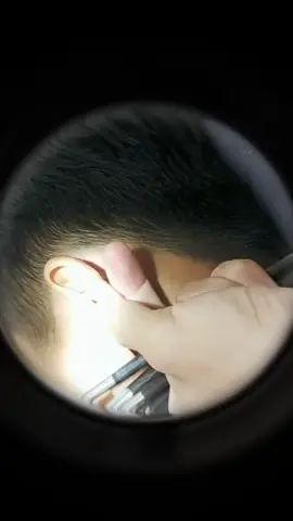 Guess how long it’s been since his ears were cleaned ?#ear #earwax #earwaxremoval #earwaxcleaning #earwaxremmoval #earwaximpaction #satisfying #relax #relaxing #relaxingvideos #foryou #fpyシ #fpy 