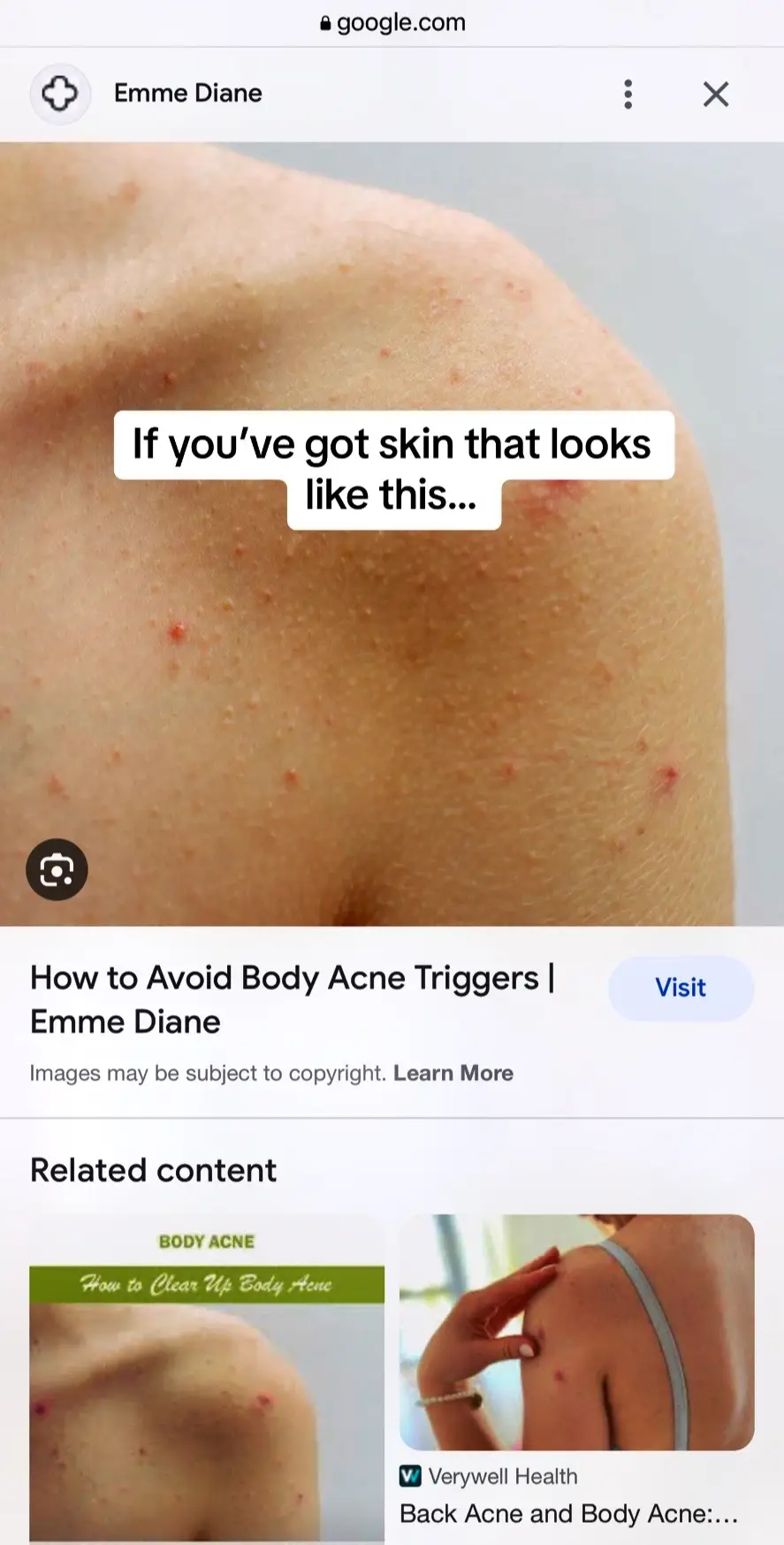 Our dry oils are non-comedogenic so they don’t clog pores and lead to break outs and they absorb quickly into the skin so you never feel greasy and don’t have to go through life with dry skin.  #dryoils #dryskincareroutine #dryoil #lotion #greasylotions #dryskinremedies #bodyoilsforskin #bodyoilhacks #dryskinhacks #skincareproductsmusthave #skincareproductsthatwork #skincareproductsyouneed #dryskinremedies #dryskinhacks #dryskin  