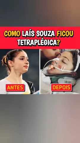 #noticias como Lais lousa ficou tetraplégica 