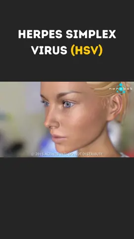 Herpes Simplex Virus (HSV) | #herpessimplex #herpessimplexvirus #herpessimplexvirus1 #hsv #hsv2 #hsv1 #hsvawareness #medical3danimation #medicalanimation #3dmedicalanimation #herpesvirus #herpesvirustreatment