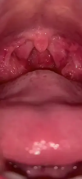 #dentistry #fypagetiktok #lipglossssssssss #oral #beautygirl #Tongue #beautiful 