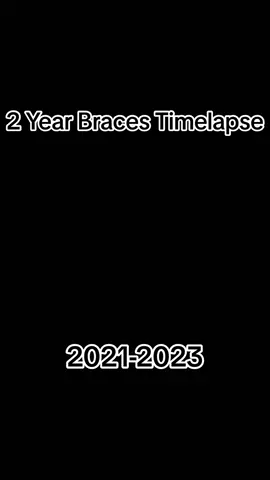 2 years of dedication 💯🔥 #braces #bracesoff #timelapse #timelapsevideo #slideshow #fyp #foryoupage 