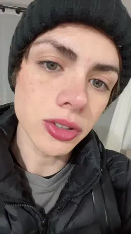 🥲