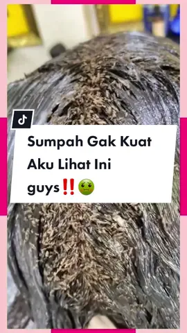 kutu sebanyak ini? #rambut #basmikuturambut #kuturambuthilang #obatkuturambut #viral 