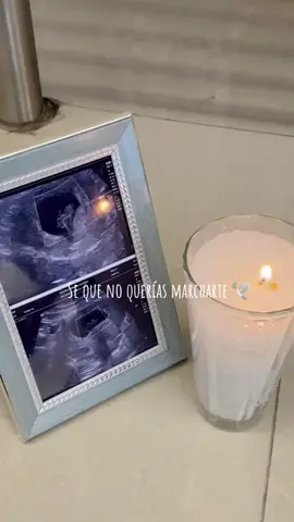 Mi bello angel😞🤍#parati #fouryoupage #perdiamibebe #perdidasperdidas #unangelenelcielo #hoysecumpleunmes #yy #yyyyyyyyyyyyyyyyyy 