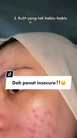 Siapa yang dah penat insecure ‼️ cuba comment sikit 👉🏻  #skinsupplement #wonderseri