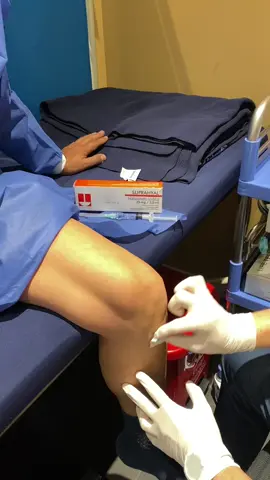 ¿Qué es la Terapia de Viscosuplementación? La infiltración de Ácido Hialurónico, también denominada Viscosuplementación, tiene el objetivo de disminuir el Dolor Articular y mejorar el estado funcional de la articulación artrósica y, más particularmente, la rodilla. En su estado normal, este líquido es muy rico en Ácido Hialurónico y lubrifica las superficies cartilaginosas por sus propiedades viscosas y las protege de los golpes por sus propiedades elásticas. Durante la Osteoartrosis, el líquido sinovial pierde Ácido Hialurónico, lo que hace al cartílago más vulnerable a las fuerzas de fricción y compresión. ¿En qué pacientes es útil la Terapia de Viscosuplementación? La Viscosuplementación puede ser utilizada en cualquier grado de Artritis, teniendo muy en cuenta que los mejores porcentajes de mejoría se logran en los grados I y II. La Viscosuplementación es un tratamiento que puede llegar a ser efectiva en un periodo de hasta 12 meses. #ortopedia #traumatologia #medicinadeportiva #traumatologosquito #traumatologoarmandohernandez 