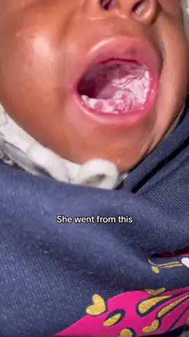 She healed from thrush and gain some weight 