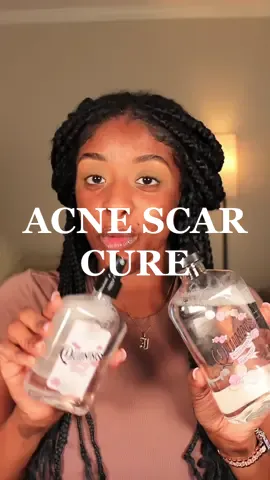 Quinn’s gifted me their witch hazel and rose water and I’m so grateful 😭 My dark spots are actually clearing up #hyperpigmentation #blackgirlskincare #witchhazeltoner #rosewaterbenefits #skincare 