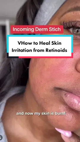 Tips for healing skin barrier from retinol irritation. #blackderm #skintips #pocskincare 