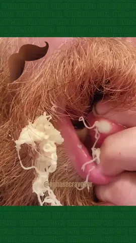 OMG LOOK THIS #satisfyingvideo #relaxing #pimplepop #espinas #pimples #espinhanaboca #fyp 