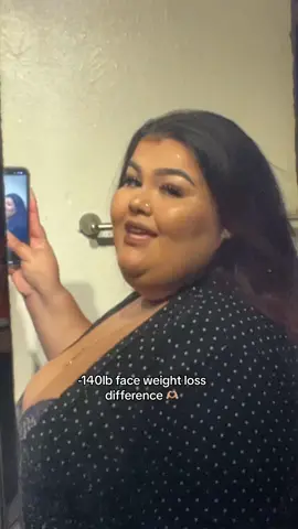 Ive lost a total of 140 lbs in 4 months #fyp #gastricbypass #weightlosscheck #weightloss #gastricbypassjourney #gastricbypasssurgey #foryoupage #foryou #tiktok 