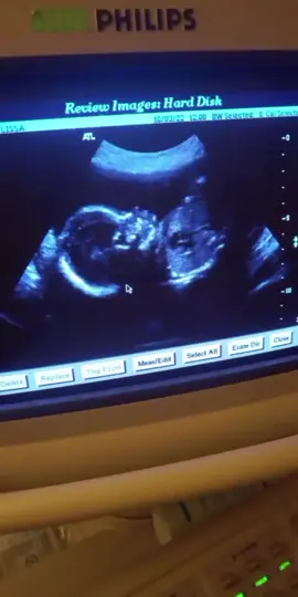 ❣️ 🥳  🎉 Happy birthday my beautiful daughter, I wish you a lifetime smile, happiness and love,shining future❤️ May God fulfill all your dreams