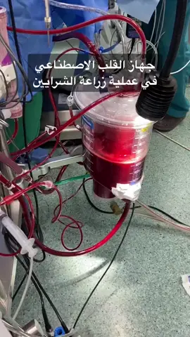 🤍🫀 نعمة العافيه لاتُقدر بثمن #الحمدلله_دائماً_وابداً #fypシ #storytime #viral #لايك__explore___  #صحه #قلب  