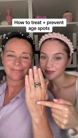 How to treat and prevent sun damage on your hands! ☀️🤚 #darkspots #hyperpigmentation #sundamage #agespots #retinol #sunprotection #skincaretips #skincareadvice #wrinkles #antiaging #antiagingtips #hyperpigmentationtreatment 