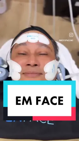 ที่ Medtopia Clinic มั่นใจได้เลยว่า ทุกเครื่องและทุกเทคโนโลยี ผ่านการทอดสอบและทดลองด้วยตัวคุณหมอเองแทบทุกเครื่องค่ะ ว่าคุณภาพดีจริง เราถึงนำเข้ามาเพื่อส่งมอบสิ่งดีๆต่อให้กับทุกท่านที่ไว้ใจให้ Medtopia Clinic ดูแลเรื่อสุขภาพและความอ่อนเยาว์🤍🤍🤍 EMFACE เหมาะกับ “ทุกคน” ที่ต้องการให้ แก้มยกขึ้น รูปหน้าโดยรวมดีขึ้น ริ้วรอยหน้าผากลดลง คิ้วยก กรอบหน้าชัดขึ้น ดูอ่อนวัยอย่างเป็นธรรมชาติ โดยเฉพาะ ผู้ที่.... ไม่อยากฉีดฟิลเลอร์/ดื้อโบท็อกซ์ กลัวเข็ม/กลัวเจ็บ/กลัวการฉีด ไม่ต้องการผ่าตัด ไม่ต้องการมี downtime นอกจากนั้น ยังเหมาะสำหรับผู้ที่ต้องการ ป้องกันความหย่อนคล้อยของใบหน้าแต่เนิ่นๆ “Prejuvenation Concept” #Medtopiaclinic #emface 