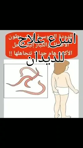 اسرع علاج للديدان عند الاطفال #التخلص#من_الديدان #الديدان_عند_الأطفال  #الديدان_الدبوسيه #الديدان_المفلطحة #الديدان_المعوية_قتلها #الديدان_الطفيليه #الديدان #الديدان_عند_الأطفال #الديدان #الديدان_عند_الأطفال #وصفه_سريعه_للديدان #كفية_التخلص_من_الديدان #الديدان  #fypシ #فلفل #foryou #محمود_الجبالي #foryoupag #tiktok_india #تك_توك #تك_توك #fyp @flfl6007 