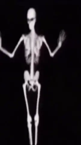 8 seconds of your skinny friend dancing #skinny #friend #skeleton #meme #dancing #fyp #fypシ #viral #foryou #xyzbca 