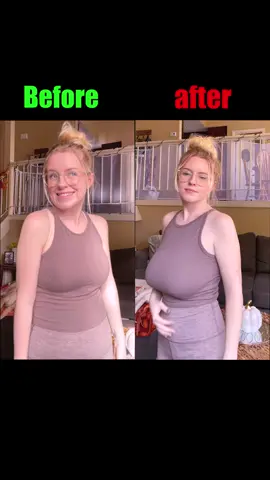 #fypシ #foryou #breastenhancement #breatdevelopment #beforeandsfter #flatchest #breastcare #breastlift #breastcncerawareness