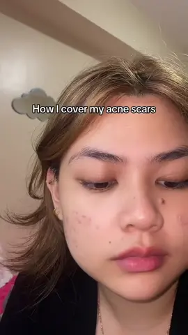 ugh my #holygrail !!!!!!! naturactor numbahh one!! #naturactor #concealer #acnescars #fyp #cosmetics