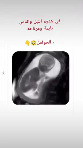 #حامل_ادعولى_اقوم_بالسلامه #حوامل_الشهر_السادس♥️ #ربي_يرزق_كل_محروم_الذريه_الصالحه 