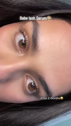 Im actually obsessed #babelashserum #longerlashes #babeoriginal #babeoriginallashserum #howtogetlongerlashes 