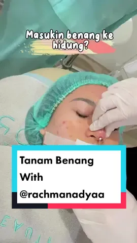 Mau hidung mancung cantik dan alami kaya kak @pinkygirlll17  Bisa banget nih tanam benang hidung kamu di Vorta Beauty Clinic!  Dijamin hasilnya se-alami itu☺✨ #hidungmancung #tanambenang #vortabeautyclinic #fyp 