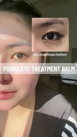 Replying to @Lisasannah975this is the only eye product you'll ever need! #eyebags #eyecare #darkeyebags #darkcircles #puffyeyes #eyebalm #pandaeyebalm 