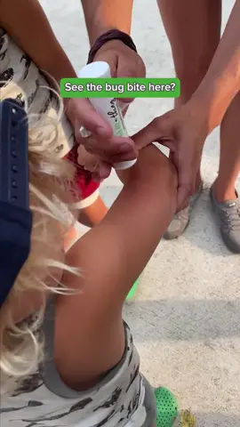 Getting bit at the park? Bug Bite Thing suctions out insect saliva & venom from bug bites & stings so you can continue to enjoy your day! 🦟🐝💚 It's safe for all ages and easy to use: *For use on children- Start with the handles down, #1️⃣ SLOWLY pull the handles up halfway or less, #2️⃣ Hold in place for 5-10 seconds, #3️⃣ Repeat 2 to 3 times on a fresh bite. You have complete control over the amount of suction used so it should NEVER be painful or leave lasting marks. 100% Money Back Guarantee! #BugBiteThing #BugBiteRelief #MosquitoBites #BugBites #KidFriendly #ParkAdventures #PlaytimeEssentials #KidEssentials 