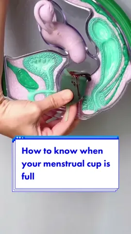Menstrual cups and discs can be great for heavy periods and even help you quantify how much you lose a day which could come in handy with your doctor. #menstrualcup #menstrualdisc #heavyperoids 
