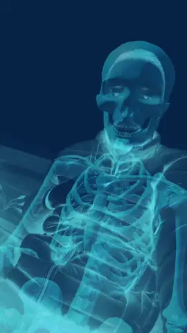 RAIO X 💀 #raiox #caveira #corpohumano #corpohumanocuriosidades #fypシ #fypシ゚viral #videoviralitiktok #tiktoknews 