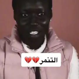 تنمر 💔#عبيدي #شعب_الصيني_ماله_حل 