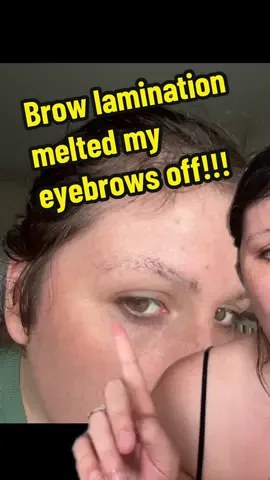 First time I’ve spoken about my brows melting off because I’ve been so upset about it, but ive finally stopped crying so here you go! #browlamination #browlaminationgonebad #noeyebrowsgang #browsgonewrong #badbrowsstory 