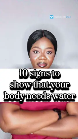 10 sugjs your body gives that shows that you need water #water #drinkwater #health #hydrate #dehydration #healthawareness #viral #trending #tiktok #tiktokvideo #viralvideo #thehealthclue 