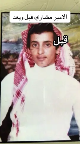 الامير مشاري قبل وبعد ⏳#الامير_مشاري #تربة #قبل_وبعد 