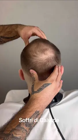 Oggi ti spieghiamo come funziona Hairfiberplus! #Hairfiberplus #capellifolti #perditadicapelli #toppic #hairloss #thinninghair 