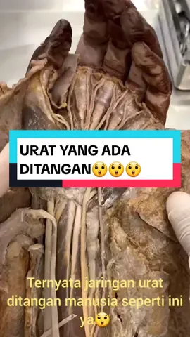 #saraftangan #jaringanurattangan #dokterbedah #dokterortopedi #doktertulang #ilmudokter #dokterhebat 