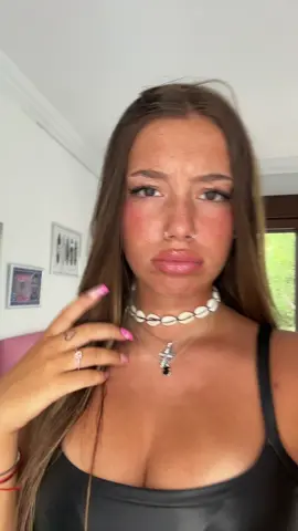 las pecas son lo mejor