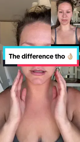 How to face your tapes #facetape #transformation #GlowUp 