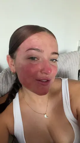 This is a reminder that acne is normal and beautiful❤️ #acnejourney #acne #positivity #acnefighter #realskin #confidence #texturedskin #acneisbeautiful #nofilter 