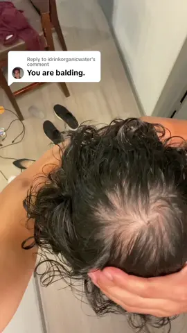 Replying to @idrinkorganicwater working on it though I’ve been using hair serum from @MAXIMHairTransplant  #hairgrowth #menshair #hairrestoration #hairlosstreatment 