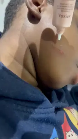 #Effective  #scar and stretch marks #remover #viral #health #trending #beauty #foxier#ghanatiktokers🇬🇭🇬🇭🇬🇭 