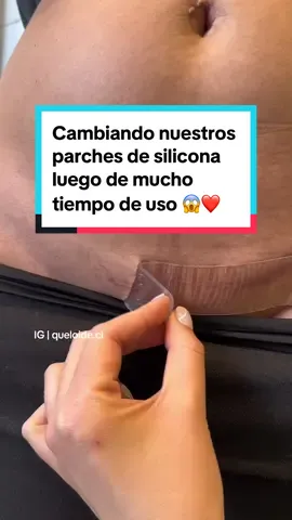 Se reutilizan a diario: se lavan, las secas y las vuelves a utilizar ☺️ asi hasta que no tengan adherencia.  DISPONIBLE EN WWW.QUELOIDE.CL/SHOP ✨ enviamos a todo Chile ❤️🇨🇱 Dejanos tus dudas en comentarios!  #tratamientodecicatrices #cicatrizhipertrofica #lentejassssssssssssssssssss #paratiiiiiiiiiiiiiiiiiiiiiiiiiiiiiii #datochile #fypシ #cicatrices #tiendaqueloide #piur #emprendimiento #parchedesilicona  