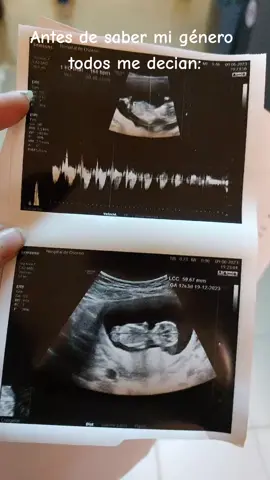 #bebe #22semanas #embarazofeliz #esniño 