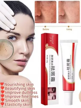 Pekas Remover Effective Melasma Cream Anti Freckle Collagen Original Skin Whitening Moisturizer