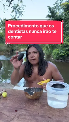 Procedimento que os dentistas nunca irão te contar #daldeia 