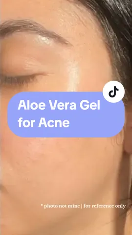 Luxe Organix Aloe Vera & Snail Soothing Gel for acne 💯 #luxeorganix  #luxeorganicph  #skincaretipsph  #acnebreakouttreatment #foryou  #fyp 