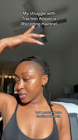 This is my traction alopecia struggle, as a young woman, I never thought i would be experiencing hairloss this early in my life, no one tells you how much this affects your confidence, i truly feel so bad about it when i see young women my age wearing their beautiful tresses with no receding hairline in sight, and i wonder if they know how lucky they are.  I would love nothing more than to wear very proudly my natural 4c hair that i have cried over and worked so hard to grow. I know there are more of us out there going through this, and this post is also serving as a show of encouragement that you are not alone. Traction Alopecia would not win this fight✨ #tractionalopecia #recedinghairline #hairlosss #4chair #lowporosity4chair #4cnaturalhair #tractionalopeciagrowth #hairgrowthjourney2023 