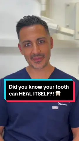 Did you know your tooth can heal itself?! #teethtok #LearnOnTikTok #pulpregenerativeprocedures #oralcare #dentist #dentisttips #dentalfacts #fyp #chelseadentalclinic #pulp 