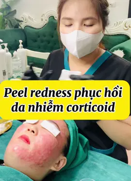 Hướng dẫn peel phục hồi , giảm đỏ ngứa cho da nhiễm corticoid #hocspa #duọcmyphamchauau #Thammylamdep #LearnOnTikTok #daotaospachuyennghiep #viral #hocspamienphi #tiktokgiaitri #xuhuong #hocspamienphi #daotaospauytin #xuhuong #GocLamDep #tiktokhot #daotaospa #trimun 